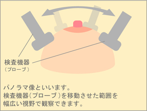 3次元画像